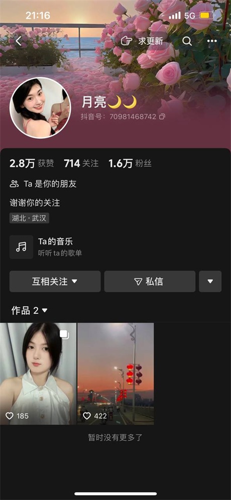 ❣️推荐❣️抖音极品嫩妹【月亮】初恋脸，极品奶子，奶头粉嫩，好漂亮的蝴蝶逼【21V】【1.71G】